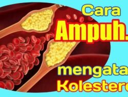 Inilah Cara Mengatasi Kolesterol Tinggi dengan Mudah dan Sehat