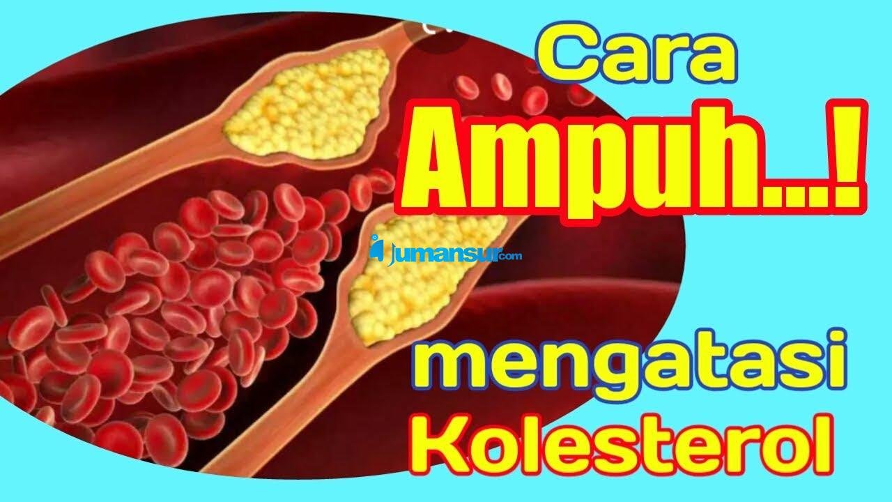 Inilah Cara Mengatasi Kolesterol Tinggi Dengan Mudah Dan Sehat 7226